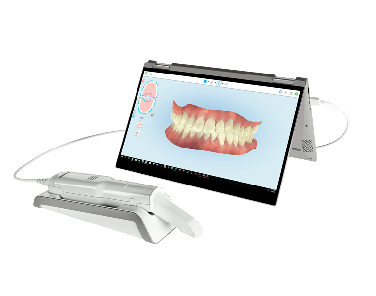 Orthodontic Scanners