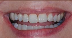 After treatment After treatment